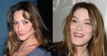 A picture of Carla Bruni before (left) and after (right).